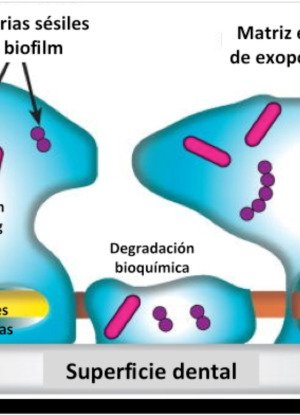 Nueva Visión en Periodontología: Prevención o Curación. Impacto del Biofilm en la Salud y Enfermedad Prof. Agustín Zerón Coordinador del Posgrado en Periodontología e Implantología en la Universidad Intercontinental, México […]