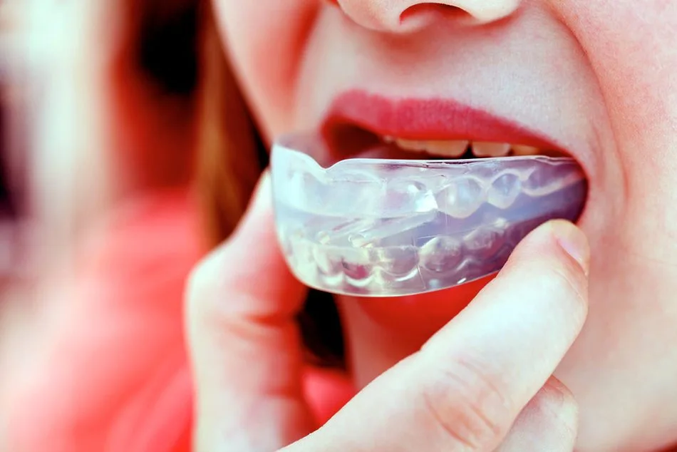 Protector Bucal Deportivo