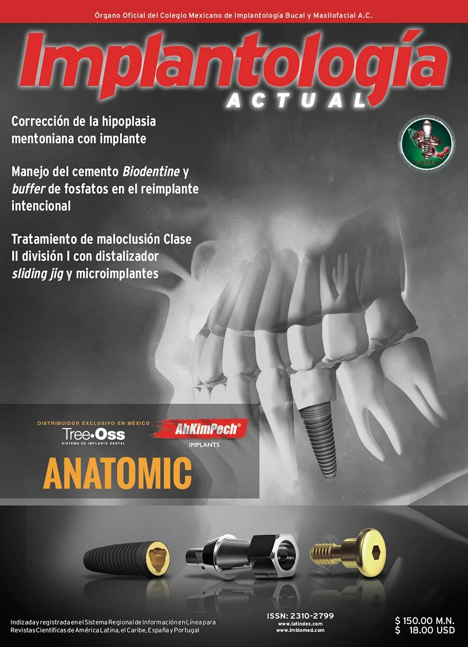 Implantología Actual 34
