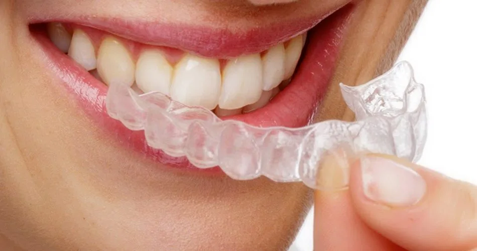 Uso integral del guarda oclusal