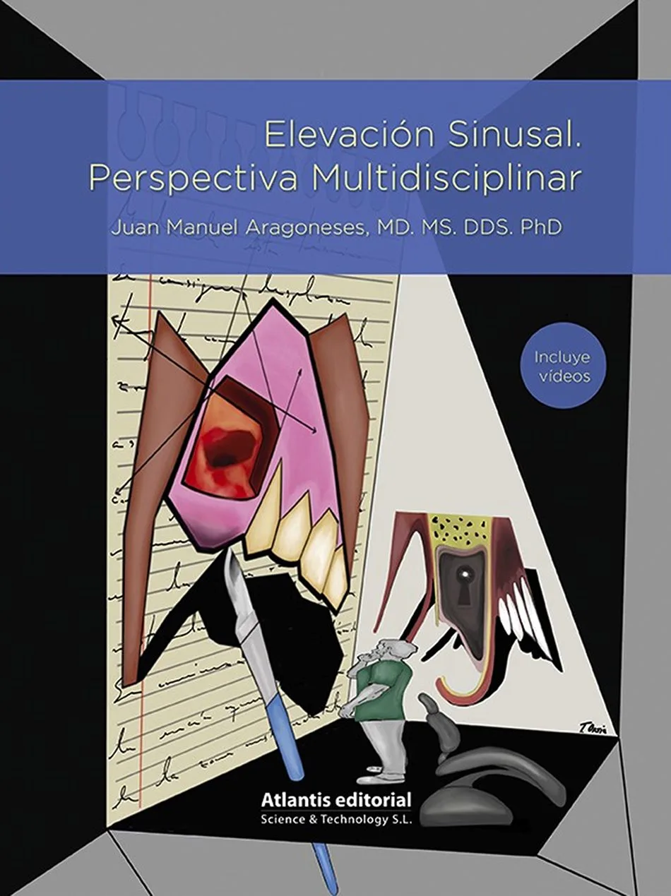 Elevación Sinusal. Perspectiva Multidisciplinar