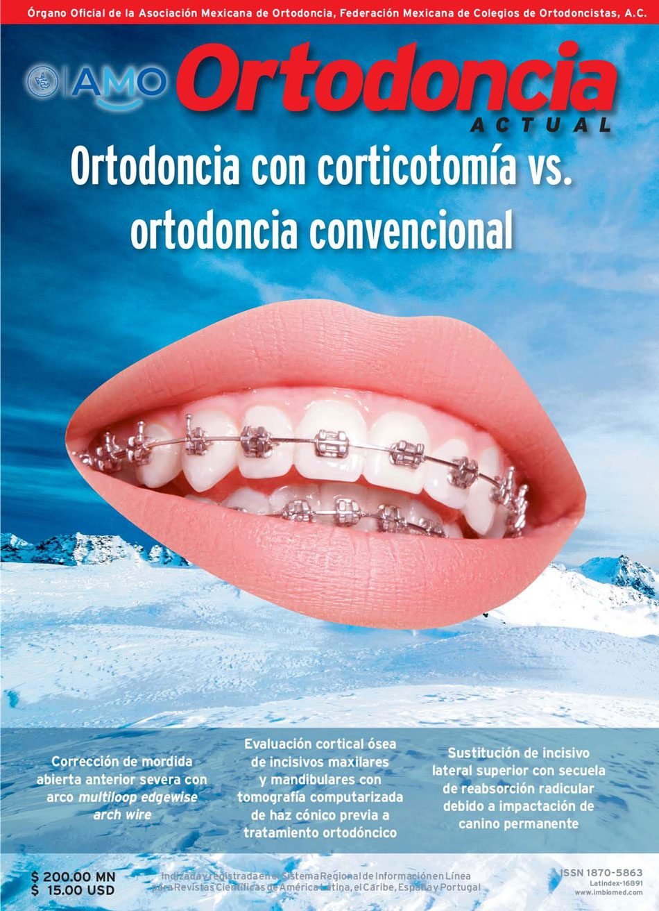 Incidencias en los Tratamientos de Ortodoncia - Novasmile