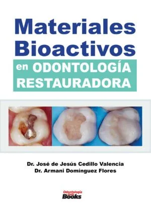 Materiales Bioactivos en Odontología Restauradora