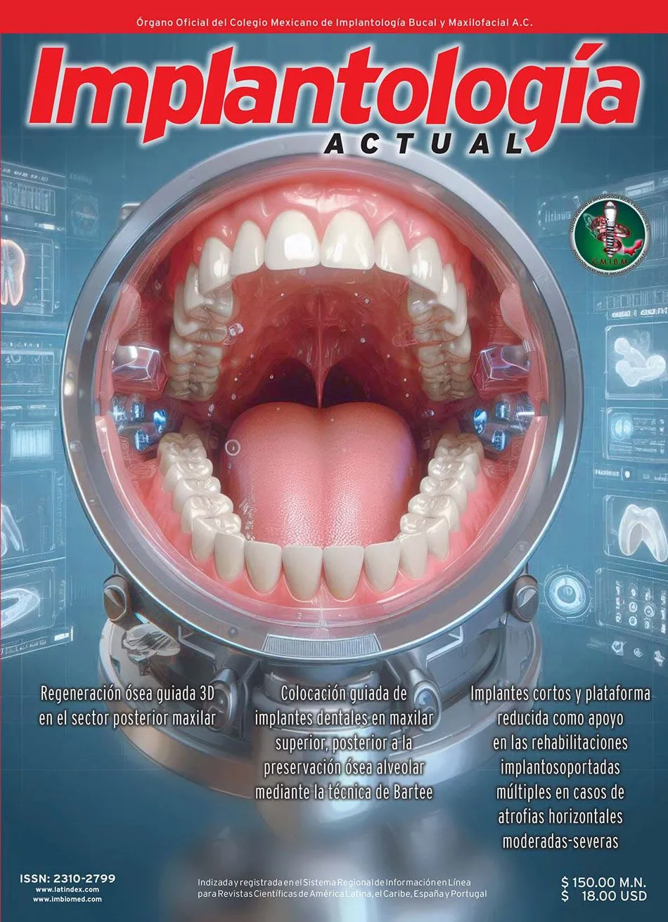 Implantología Actual - Digital - Imagen 6