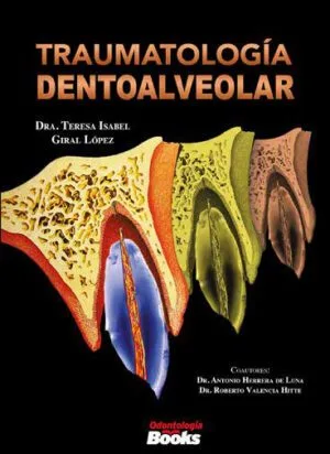 Traumatología dentoalveolar