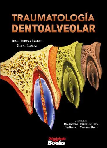 Traumatología dentoalveolar