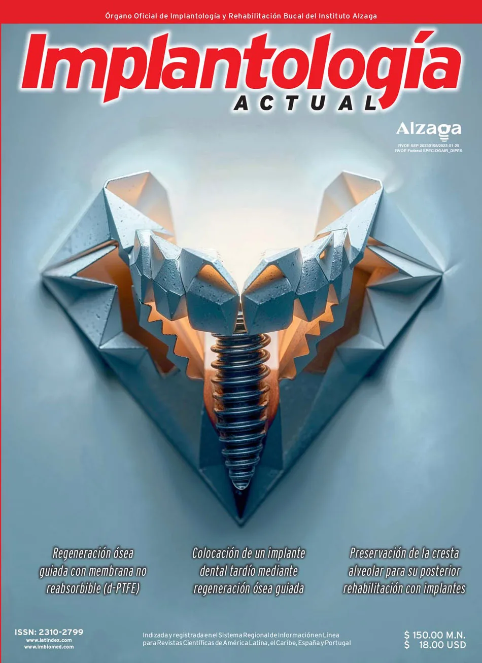 Implantología Actual - Digital - Imagen 2
