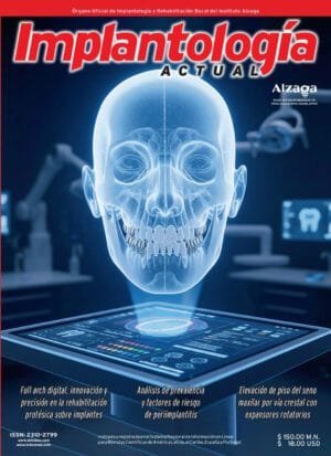 Implantología Actual - Digital