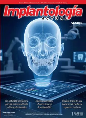 Implantología Actual - Digital