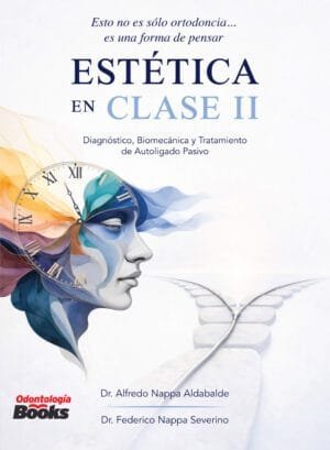 Estética en Clase II - Diagnóstico, biomecánica y tratamiento de Autoligado Pasivo