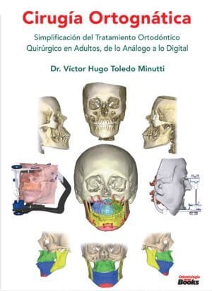 Cirugía Ortognática