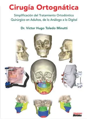 Cirugía Ortognática