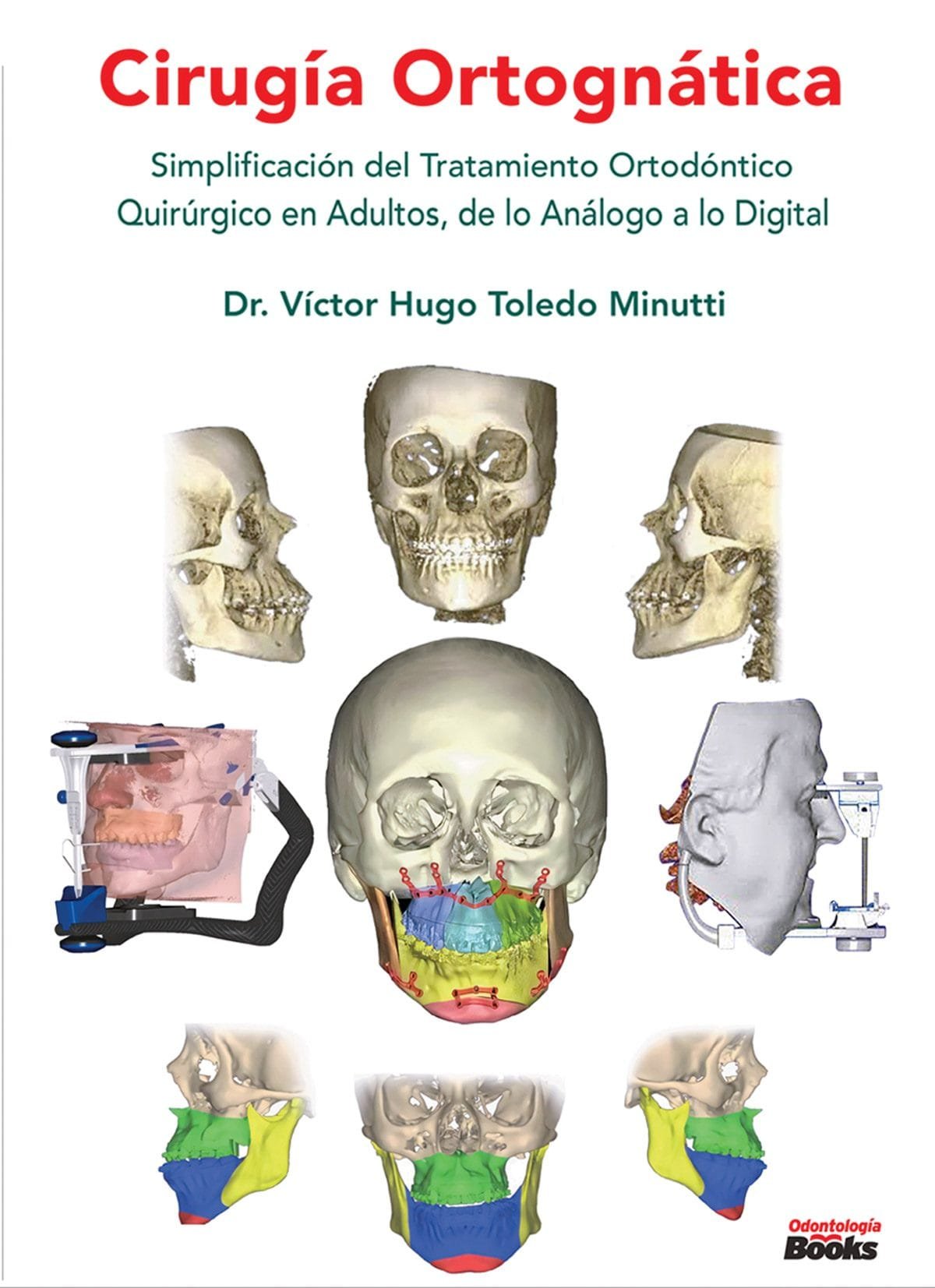 Cirugía Ortognática