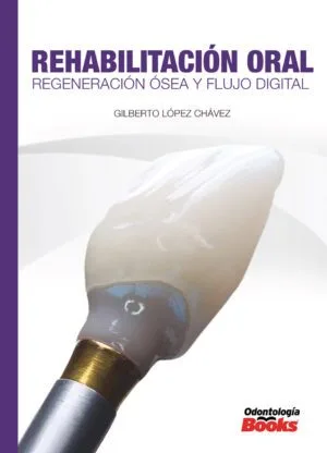Rehabilitación Oral