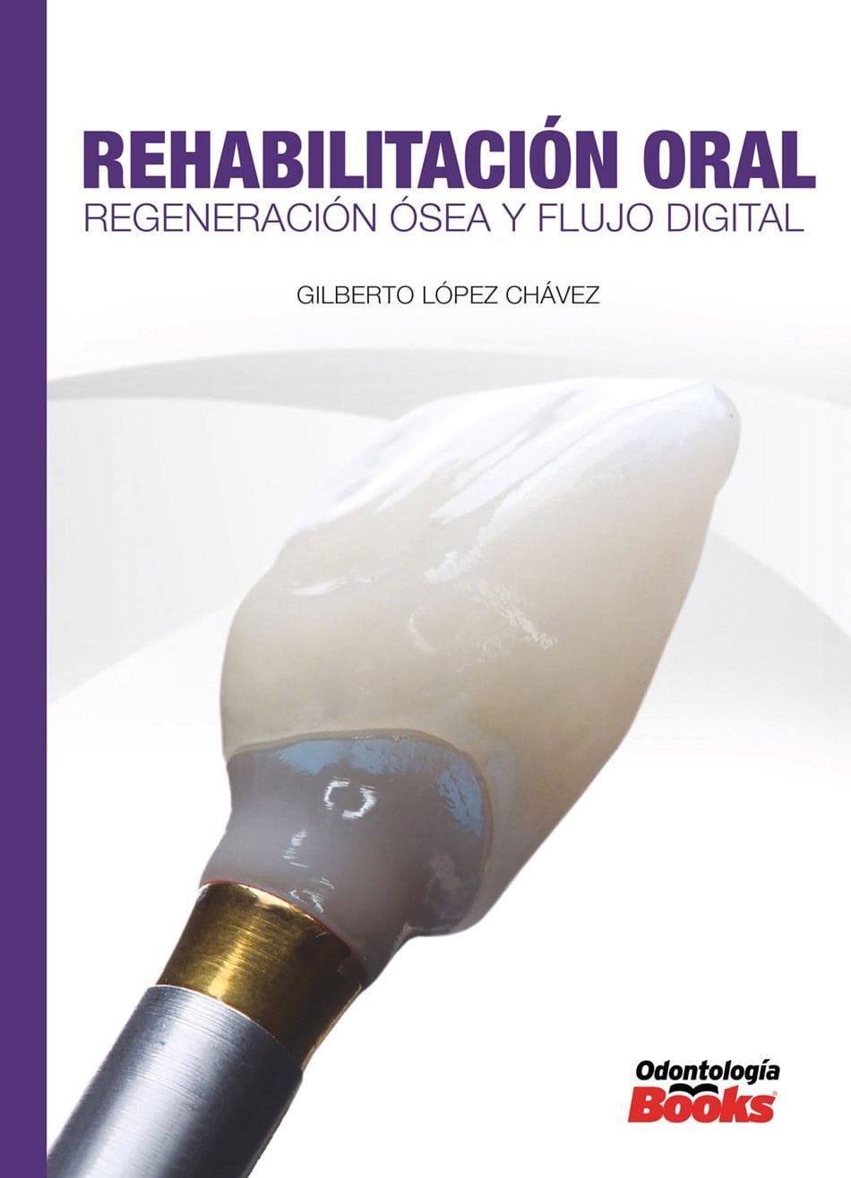 Rehabilitación Oral